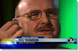 Tris Thomson laser eye injury